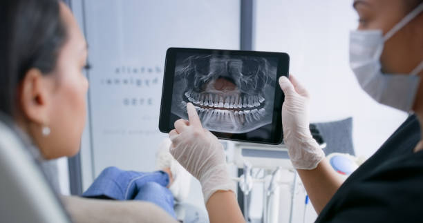 Licensed Dental Implants service in California Polytechnic State University, CA - Smile Center Dentistry
